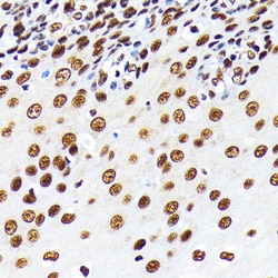 Invitrogen HuR Recombinant Rabbit Monoclonal Antibody (9Q6L3) 100 &mu;L;