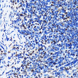 Invitrogen HuR Recombinant Rabbit Monoclonal Antibody (9Q6L3) 100 &mu;L;