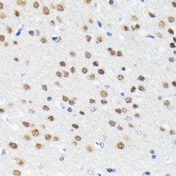 Invitrogen Cullin 3 Recombinant Rabbit Monoclonal Antibody (7W3E3) 100