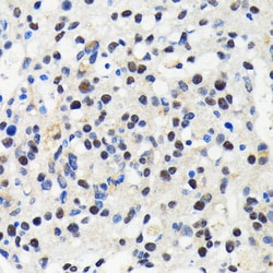 Invitrogen Cullin 3 Recombinant Rabbit Monoclonal Antibody (7W3E3) 100