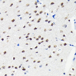 Invitrogen Cullin 3 Recombinant Rabbit Monoclonal Antibody (7W3E3) 100