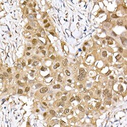 Invitrogen ERK2 Recombinant Rabbit Monoclonal Antibody (2K9N9) 100 &mu;L;