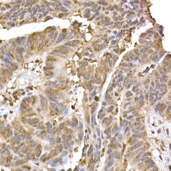 Invitrogen ERK2 Recombinant Rabbit Monoclonal Antibody (2K9N9) 100 &mu;L;
