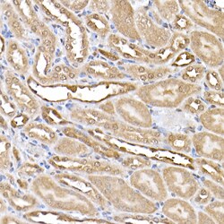 Invitrogen ERK2 Recombinant Rabbit Monoclonal Antibody (2K9N9) 100 &mu;L;