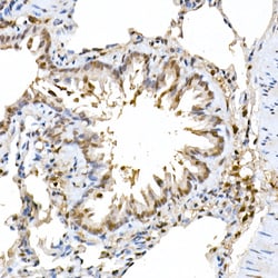 Invitrogen ERK2 Recombinant Rabbit Monoclonal Antibody (2K9N9) 100 &mu;L;