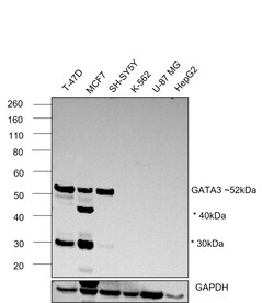 Invitrogen GATA3 Recombinant Rabbit Monoclonal Antibody (6V3Z4) 100 &mu;L | Buy Online | Invitrogen&trade; | Fisher Scientific