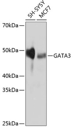 Invitrogen GATA3 Recombinant Rabbit Monoclonal Antibody (6V3Z4) 100 &mu;L | Buy Online | Invitrogen&trade; | Fisher Scientific