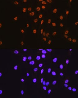 Invitrogen SP1 Recombinant Rabbit Monoclonal Antibody (5I3A8) 100 &mu;L;