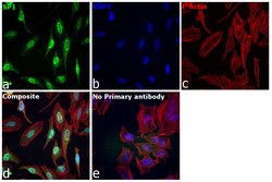 Invitrogen SP1 Recombinant Rabbit Monoclonal Antibody (5I3A8) 100 &mu;L;