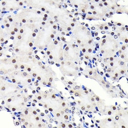 Invitrogen SP1 Recombinant Rabbit Monoclonal Antibody (5I3A8) 100 &mu;L;