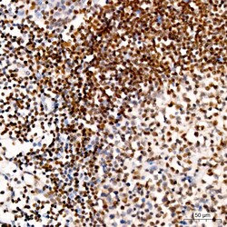 Invitrogen ATM Recombinant Rabbit Monoclonal Antibody (6P6C6) 100 &mu;L;