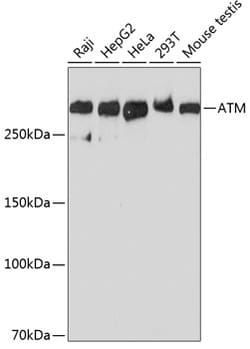 Invitrogen ATM Recombinant Rabbit Monoclonal Antibody (6P6C6) 100 &mu;L;
