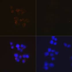 Invitrogen Caspase 3 p12 Recombinant Rabbit Monoclonal Antibody (1P3B3)