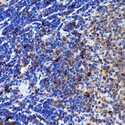 Invitrogen Caspase 3 p12 Recombinant Rabbit Monoclonal Antibody (1P3B3)
