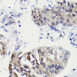 Invitrogen Caspase 3 p12 Recombinant Rabbit Monoclonal Antibody (1P3B3)