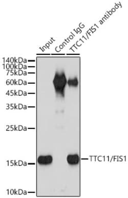 Invitrogen FIS1 Recombinant Rabbit Monoclonal Antibody (6S1G4) 100 &mu;L | Buy Online | Invitrogen&trade; | Fisher Scientific