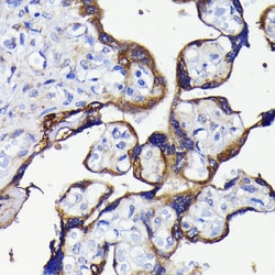 Invitrogen ATG5 Recombinant Rabbit Monoclonal Antibody (8L7X6) 100 &mu;L;