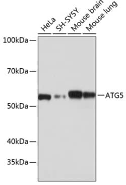 Invitrogen ATG5 Recombinant Rabbit Monoclonal Antibody (8L7X6) 100 &mu;L;