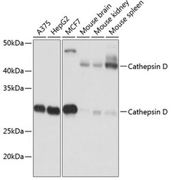 Invitrogen Cathepsin D Recombinant Rabbit Monoclonal Antibody (2B3E8) 100 &mu;L | Buy Online | Invitrogen&trade; | Fisher Scientific