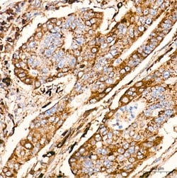 Invitrogen Cathepsin D Recombinant Rabbit Monoclonal Antibody (2B3E8) 100 &mu;L | Buy Online | Invitrogen&trade; | Fisher Scientific