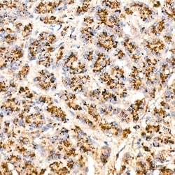 Invitrogen Cathepsin D Recombinant Rabbit Monoclonal Antibody (2B3E8) 100 &mu;L | Buy Online | Invitrogen&trade; | Fisher Scientific