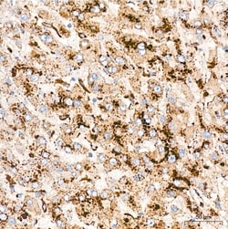 Invitrogen Cathepsin D Recombinant Rabbit Monoclonal Antibody (2B3E8) 100 &mu;L | Buy Online | Invitrogen&trade; | Fisher Scientific