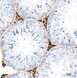 Invitrogen Cathepsin D Recombinant Rabbit Monoclonal Antibody (2B3E8) 100 &mu;L | Buy Online | Invitrogen&trade; | Fisher Scientific