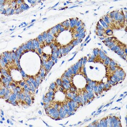Invitrogen BAX Recombinant Rabbit Monoclonal Antibody (5K8X4) 100 &mu;L;