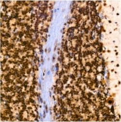 Invitrogen PIM1 Recombinant Rabbit Monoclonal Antibody (4C8D0) 100 &mu;L;