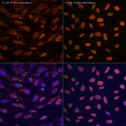 Invitrogen N6-Methyladenosine (m6A) Recombinant Rabbit Monoclonal Antibody