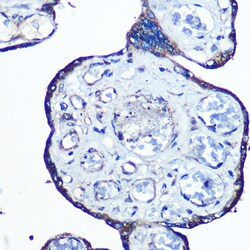 Invitrogen N-WASP Recombinant Rabbit Monoclonal Antibody (4P5M9) 100 &mu;L;