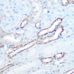 Invitrogen N-WASP Recombinant Rabbit Monoclonal Antibody (4P5M9) 100 &mu;L;
