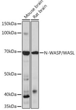 Invitrogen N-WASP Recombinant Rabbit Monoclonal Antibody (4P5M9) 100 &mu;L;