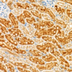 Invitrogen GCN2 Recombinant Rabbit Monoclonal Antibody (1G2Z4) 100 &mu;L;