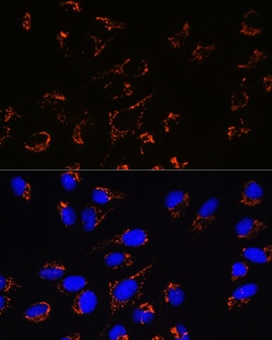 Invitrogen PRDX3 Recombinant Rabbit Monoclonal Antibody (4K7D1) 100 &mu;L:Antibodies,