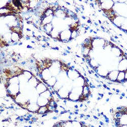 Invitrogen PRDX3 Recombinant Rabbit Monoclonal Antibody (4K7D1) 100 &mu;L:Antibodies,