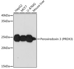 Invitrogen PRDX3 Recombinant Rabbit Monoclonal Antibody (4K7D1) 100 &mu;L:Antibodies,