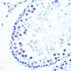 Invitrogen POLB Recombinant Rabbit Monoclonal Antibody (6M8I5) 100 &mu;L;