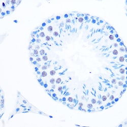 Invitrogen POLB Recombinant Rabbit Monoclonal Antibody (6M8I5) 100 &mu;L;