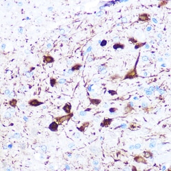 Invitrogen gamma Synuclein Recombinant Rabbit Monoclonal Antibody (4A0F4)