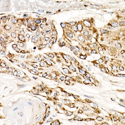Invitrogen TFAM Recombinant Rabbit Monoclonal Antibody (4H2M9) 100 &mu;L;
