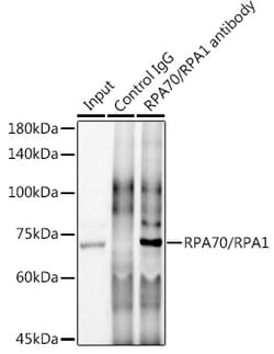 Invitrogen RPA70 Recombinant Rabbit Monoclonal Antibody (5R7S3) 100 &mu;L | Buy Online | Invitrogen&trade; | Fisher Scientific