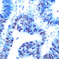 Invitrogen USP7 Recombinant Rabbit Monoclonal Antibody (3J7G1) 100 &mu;L;