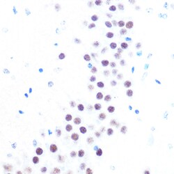 Invitrogen USP7 Recombinant Rabbit Monoclonal Antibody (3J7G1) 100 &mu;L;