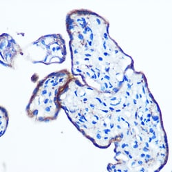 Invitrogen IKK epsilon Recombinant Rabbit Monoclonal Antibody (5N4J8) 100