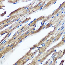 Invitrogen IKK epsilon Recombinant Rabbit Monoclonal Antibody (5N4J8) 100