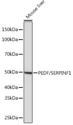 Invitrogen PEDF Recombinant Rabbit Monoclonal Antibody (4H0C5) 100 &mu;L;
