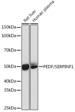 Invitrogen PEDF Recombinant Rabbit Monoclonal Antibody (4H0C5) 100 &mu;L;