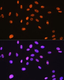 Invitrogen SFPQ Recombinant Rabbit Monoclonal Antibody (8Y5S6) 100 &mu;L;