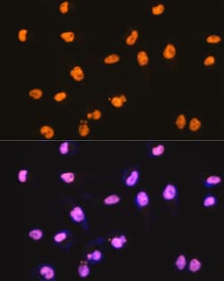 Invitrogen SFPQ Recombinant Rabbit Monoclonal Antibody (8Y5S6) 100 &mu;L;